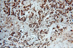 TPD52L2 Rabbit anti-Human, Mouse, Rat, Polyclonal, Proteintech 150 &mu;L;