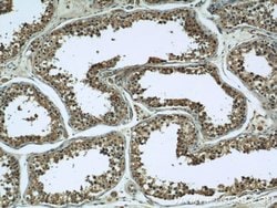 TPD52L2 Rabbit anti-Human, Mouse, Rat, Polyclonal, Proteintech 150 &mu;L;