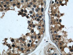 TPD52L2 Rabbit anti-Human, Mouse, Rat, Polyclonal, Proteintech 150 &mu;L;