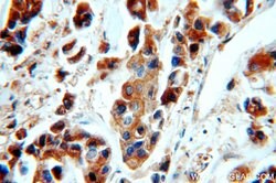 TPD52L2 Rabbit anti-Human, Mouse, Rat, Polyclonal, Proteintech 150 &mu;L;
