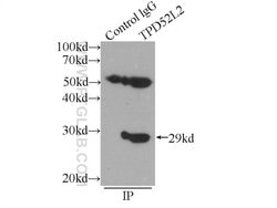 TPD52L2 Rabbit anti-Human, Mouse, Rat, Polyclonal, Proteintech 150 &mu;L;