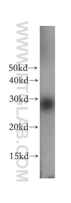TPD52L2 Rabbit anti-Human, Mouse, Rat, Polyclonal, Proteintech 150 &mu;L;