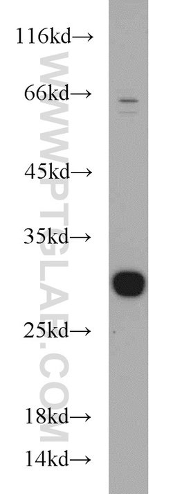 TPD52L2 Rabbit anti-Human, Mouse, Rat, Polyclonal, Proteintech 150 &mu;L;