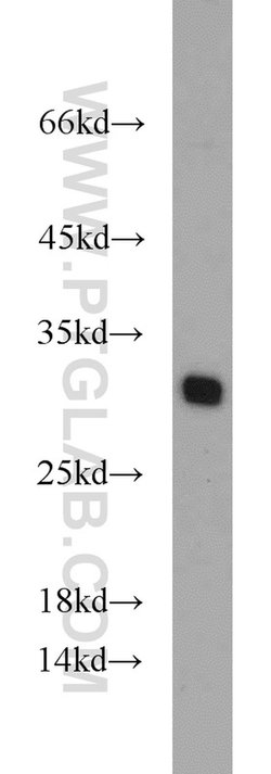 TPD52L2 Rabbit anti-Human, Mouse, Rat, Polyclonal, Proteintech 150 &mu;L;