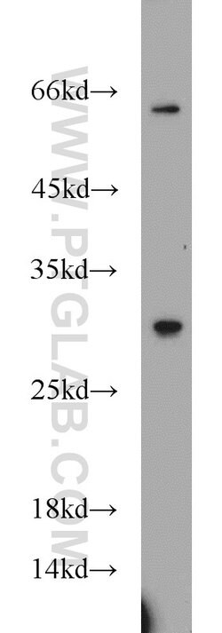 TPD52L2 Rabbit anti-Human, Mouse, Rat, Polyclonal, Proteintech 150 &mu;L;
