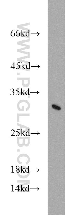 TPD52L2 Rabbit anti-Human, Mouse, Rat, Polyclonal, Proteintech 150 &mu;L;