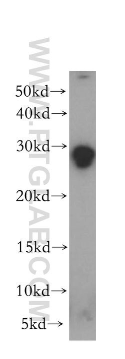 TPD52L2 Rabbit anti-Human, Mouse, Rat, Polyclonal, Proteintech 150 &mu;L;