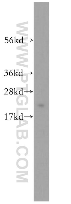TPD52L2 Rabbit anti-Human, Mouse, Rat, Polyclonal, Proteintech 150 &mu;L;