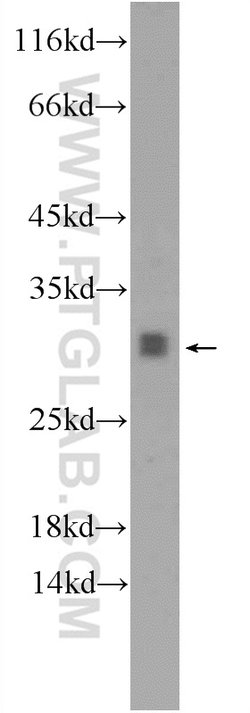 TPD52L2 Rabbit anti-Human, Mouse, Rat, Polyclonal, Proteintech 150 &mu;L;
