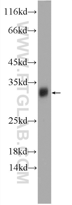TPD52L2 Rabbit anti-Human, Mouse, Rat, Polyclonal, Proteintech 150 &mu;L;