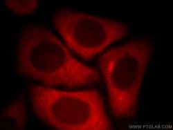 KYNU Rabbit anti-Human, Mouse, Rat, Polyclonal, Proteintech 150 &mu;L;