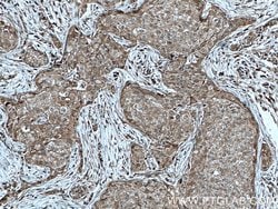 KYNU Rabbit anti-Human, Mouse, Rat, Polyclonal, Proteintech 150 &mu;L;
