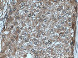 KYNU Rabbit anti-Human, Mouse, Rat, Polyclonal, Proteintech 150 &mu;L;