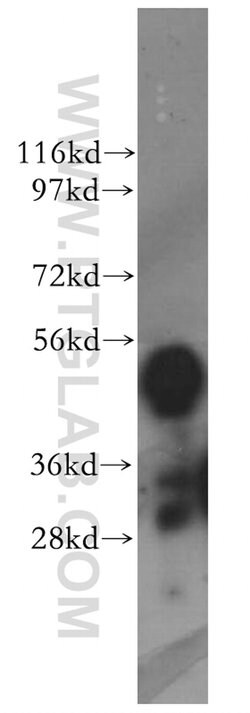 KYNU Rabbit anti-Human, Mouse, Rat, Polyclonal, Proteintech 150 &mu;L;