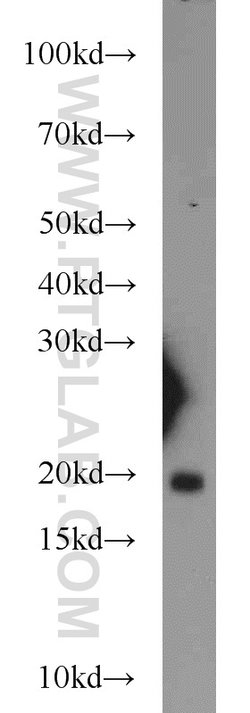 BUD31 Rabbit anti-Human, Mouse, Rat, Polyclonal, Proteintech:Antibodies:Primary