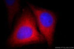 S100P Rabbit anti-Human, Polyclonal, Proteintech 150 &mu;L; Unconjugated:Antibodies,