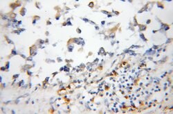 S100P Rabbit anti-Human, Polyclonal, Proteintech 150 &mu;L; Unconjugated:Antibodies,