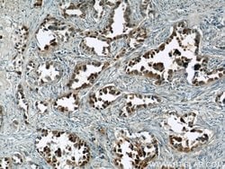 S100P Rabbit anti-Human, Polyclonal, Proteintech 150 &mu;L; Unconjugated:Antibodies,