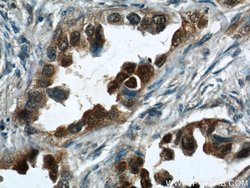 S100P Rabbit anti-Human, Polyclonal, Proteintech 150 &mu;L; Unconjugated:Antibodies,