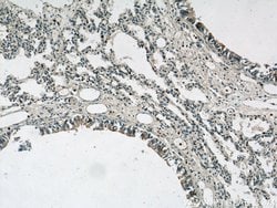 S100P Rabbit anti-Human, Polyclonal, Proteintech 150 &mu;L; Unconjugated:Antibodies,