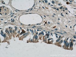 S100P Rabbit anti-Human, Polyclonal, Proteintech 150 &mu;L; Unconjugated:Antibodies,
