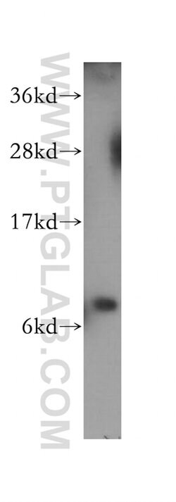 S100P Rabbit anti-Human, Polyclonal, Proteintech 150 &mu;L; Unconjugated:Antibodies,