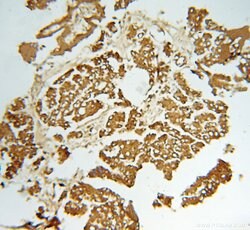 CAPZA1 Rabbit anti-Human, Mouse, Rat, Polyclonal, Proteintech:Antibodies:Primary