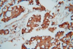 CAPZA1 Rabbit anti-Human, Mouse, Rat, Polyclonal, Proteintech:Antibodies:Primary