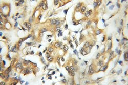 CAPZA1 Rabbit anti-Human, Mouse, Rat, Polyclonal, Proteintech:Antibodies:Primary