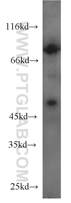 SIRP BETA 1 Rabbit anti-Human, Polyclonal, Proteintech 150 &mu;L; Unconjugated:Antibodies,