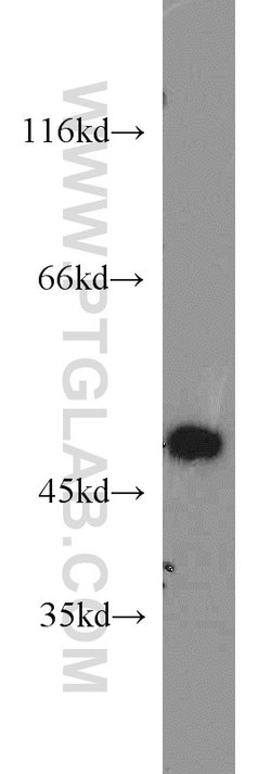 SIRP BETA 1 Rabbit anti-Human, Polyclonal, Proteintech 150 &mu;L; Unconjugated:Antibodies,