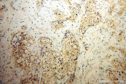 SIRP BETA 1 Rabbit anti-Human, Polyclonal, Proteintech 150 &mu;L; Unconjugated:Antibodies,