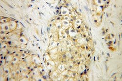 SIRP BETA 1 Rabbit anti-Human, Polyclonal, Proteintech 150 &mu;L; Unconjugated:Antibodies,