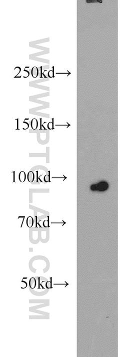 CILP2 Rabbit anti-Human, Mouse, Polyclonal, Proteintech 150 &mu;L; Unconjugated:Antibodies,