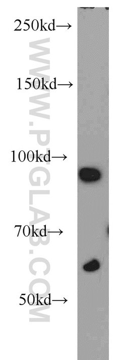 CILP2 Rabbit anti-Human, Mouse, Polyclonal, Proteintech 150 &mu;L; Unconjugated:Antibodies,