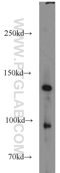 CILP2 Rabbit anti-Human, Mouse, Polyclonal, Proteintech 150 &mu;L; Unconjugated:Antibodies,