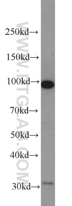 CILP2 Rabbit anti-Human, Mouse, Polyclonal, Proteintech 150 &mu;L; Unconjugated:Antibodies,