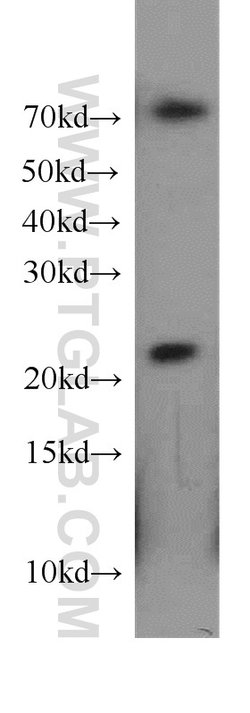CDC42EP2 Rabbit anti-Human, Mouse, Rat, Polyclonal, Proteintech:Antibodies:Primary