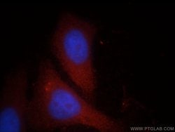 FGL2 Rabbit anti-Human, Mouse, Rat, Polyclonal, Proteintech:Antibodies:Primary