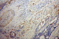 FGL2 Rabbit anti-Human, Mouse, Rat, Polyclonal, Proteintech:Antibodies:Primary