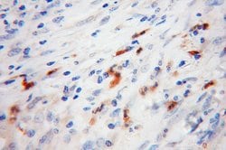 Proteintech FGL2 Rabbit anti-Human, Mouse, Rat, Polyclonal, Proteintech