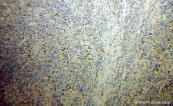FGL2 Rabbit anti-Human, Mouse, Rat, Polyclonal, Proteintech:Antibodies:Primary