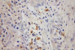 FGL2 Rabbit anti-Human, Mouse, Rat, Polyclonal, Proteintech:Antibodies:Primary