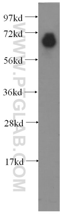 FGL2 Rabbit anti-Human, Mouse, Rat, Polyclonal, Proteintech:Antibodies:Primary