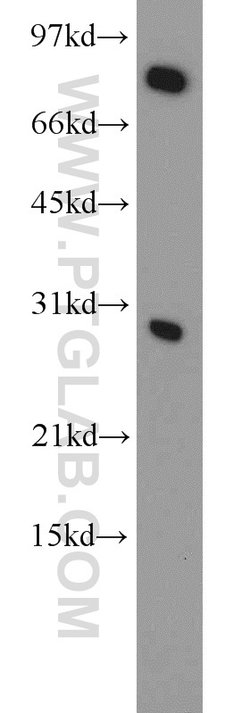 CBX5 Rabbit anti-Human, Mouse, Rat, Polyclonal, Proteintech 150 &mu;L;