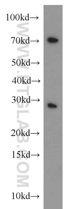 CBX5 Rabbit anti-Human, Mouse, Rat, Polyclonal, Proteintech 150 &mu;L;