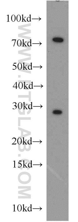 CBX5 Rabbit anti-Human, Mouse, Rat, Polyclonal, Proteintech 150 &mu;L;