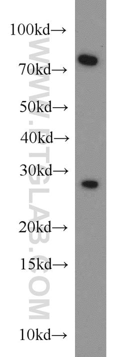 CBX5 Rabbit anti-Human, Mouse, Rat, Polyclonal, Proteintech 150 &mu;L;