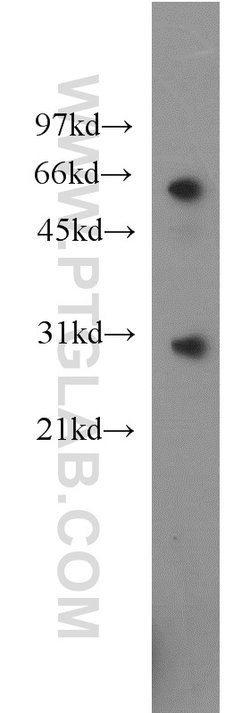 CBX5 Rabbit anti-Human, Mouse, Rat, Polyclonal, Proteintech 150 &mu;L;