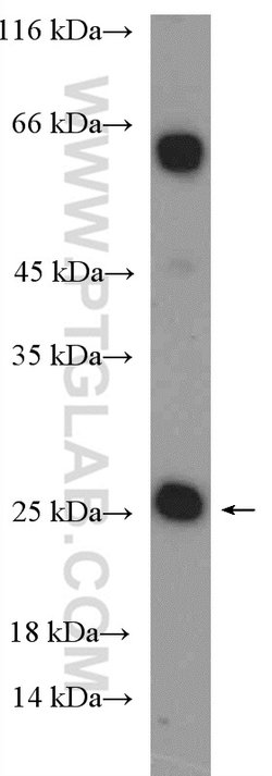 CBX5 Rabbit anti-Human, Mouse, Rat, Polyclonal, Proteintech 150 &mu;L;